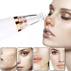 Succionador de poros obstruidos